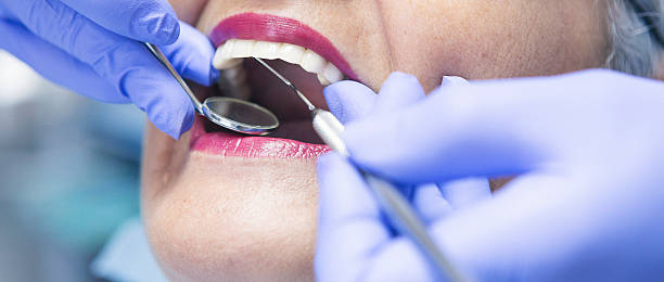 Best Walk-In Emergency Dental Services in Clear Lake, IA